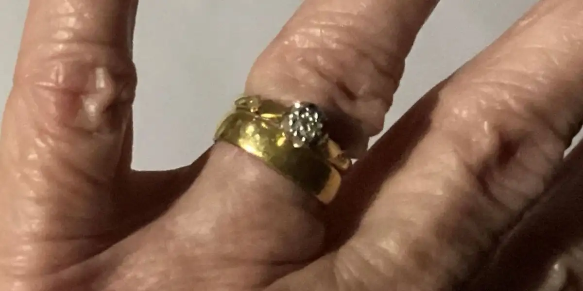 Donna ritrova il suo anello di fidanzamento dopo 54 anni